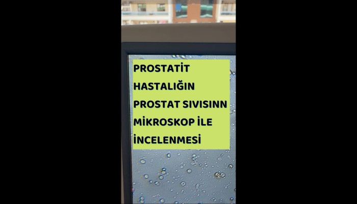 üroloji doktoru,sertleşme bozukluğu,iktidarsızlık,sertleşme sorunu,manisa üroloji,ömür erdem akkaya