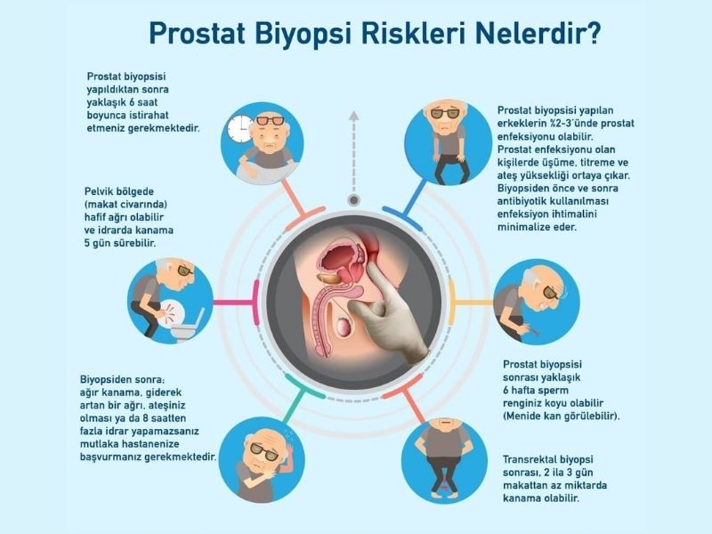 Prostat Biyopsisi Riskleri